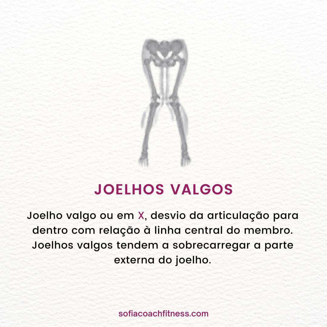 joelhos valgos