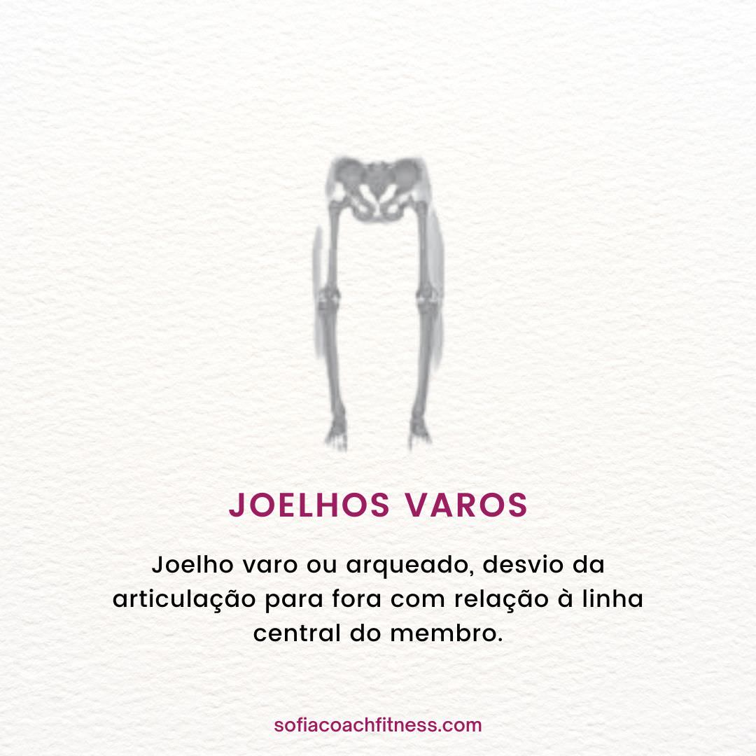 joelhos varos